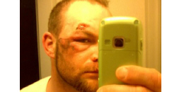 Five Finger Death Punch - karambol