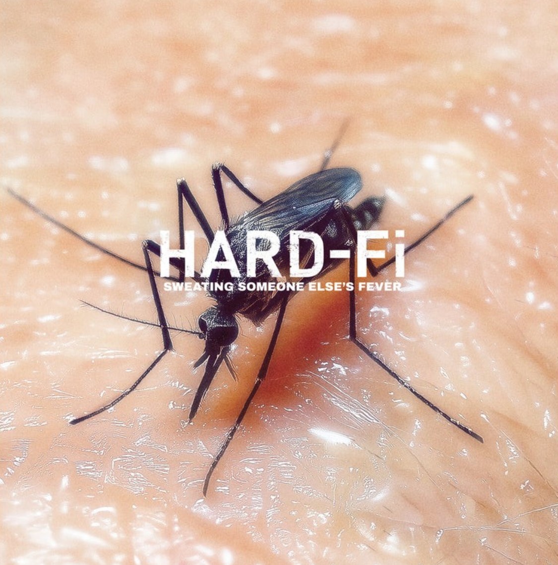 HARD-FI: a hullámzó önbizalomról szól a „Now and Then”